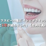 マウスピース矯正(インビザライン)を初めて1年が経ちました！【症例写真付き】