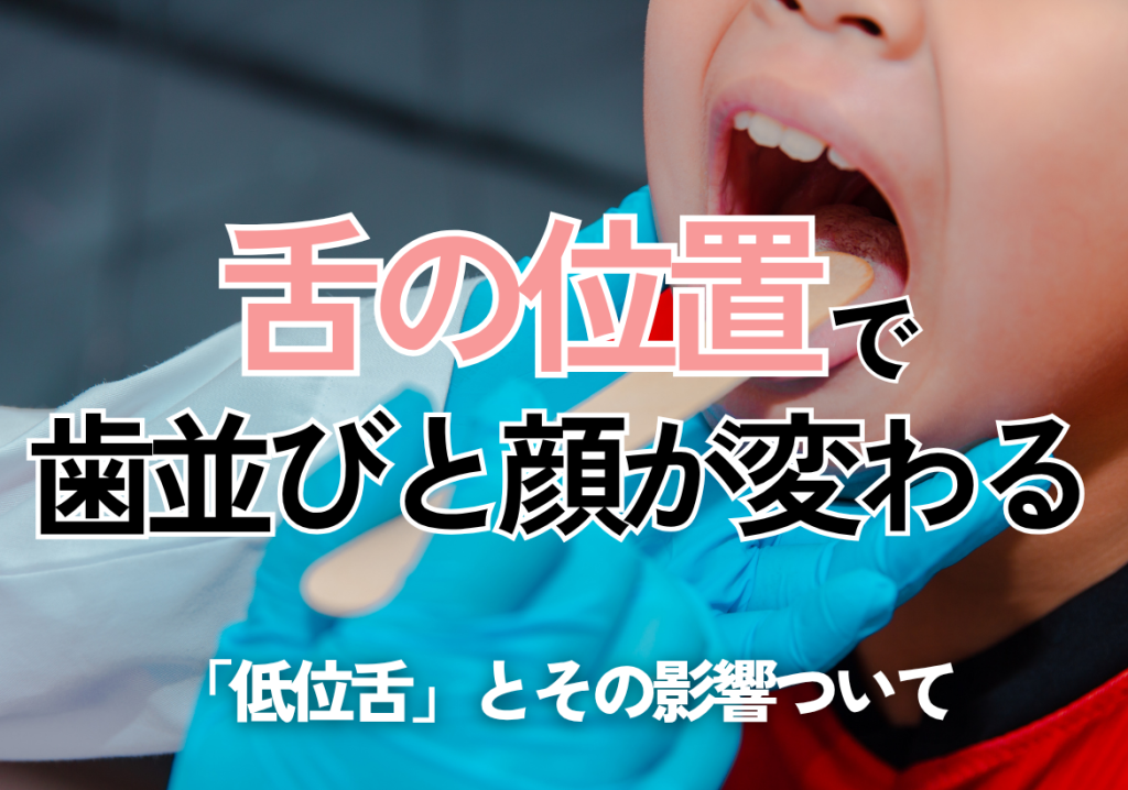 子どもの「低位舌」と歯並びの関係｜早めの矯正相談で整える舌の位置と呼吸習慣【尼崎駅前歯科】