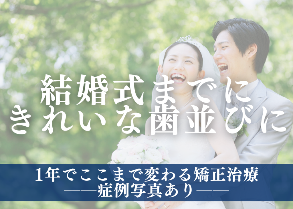 結婚式までに歯並びも美しくしたい方へ──1年でここまで変わる矯正治療【症例写真あり】