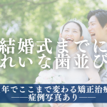 結婚式までに歯並びも美しくしたい方へ──1年でここまで変わる矯正治療【症例写真あり】