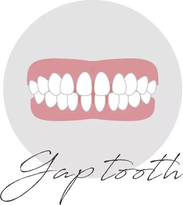 Gap tooth